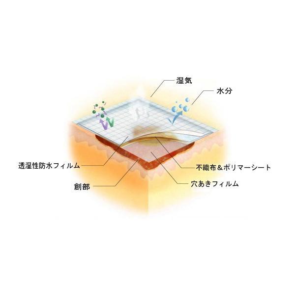 白十字 （2箱セット）モイスキンパッド7520／30袋入（白十字）滅菌済