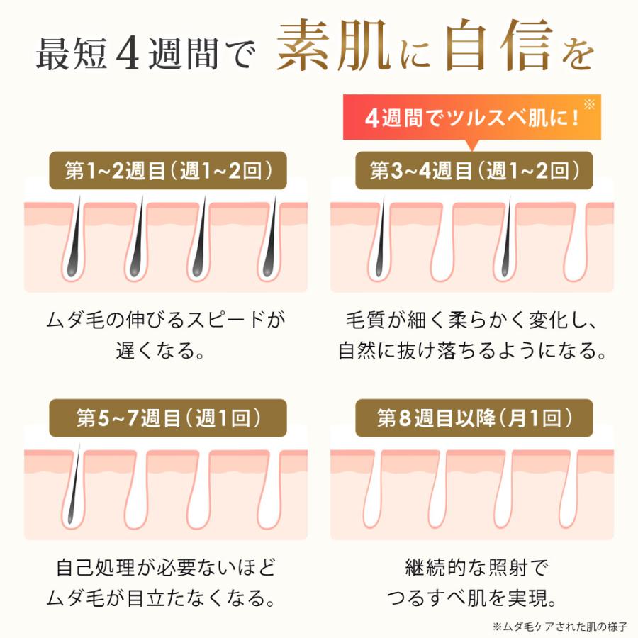FASCINATEBEAUTY - 脱毛器 IPL 光美容器 VIO相応う 五体相応う EPIFLASH 冷やかす役立つこと 身寄り用 住まい メンズ レディース FN-IPE010-W