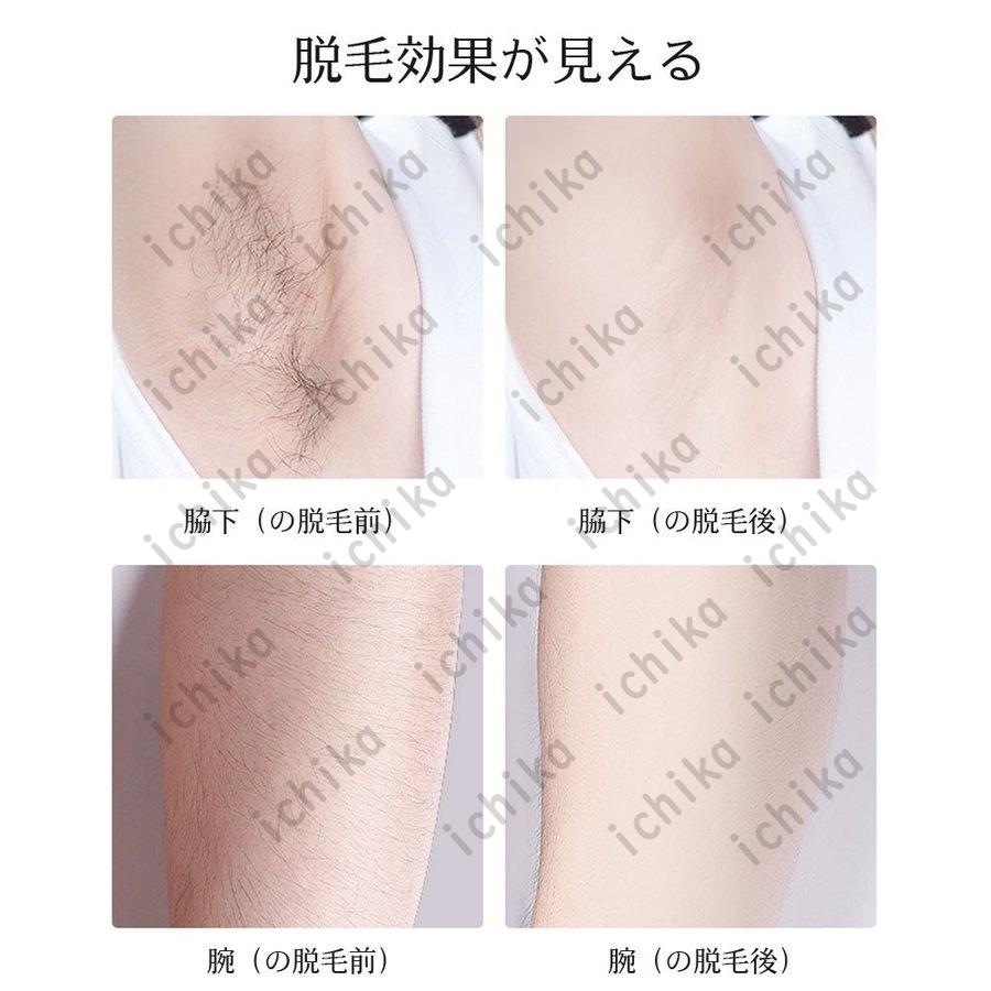 倍 倍 倍 送料無料 脱毛器 Vio 女性 レディース メンズ 光 ビキニ 顔 髭 脇 太腿 全身脱毛 Ipl フラッシュ 脱毛機 プレゼント ギフト スマスコフレ Ichika Jd Tmq 07 Ichika自動車用品 通販 Yahoo ショッピング