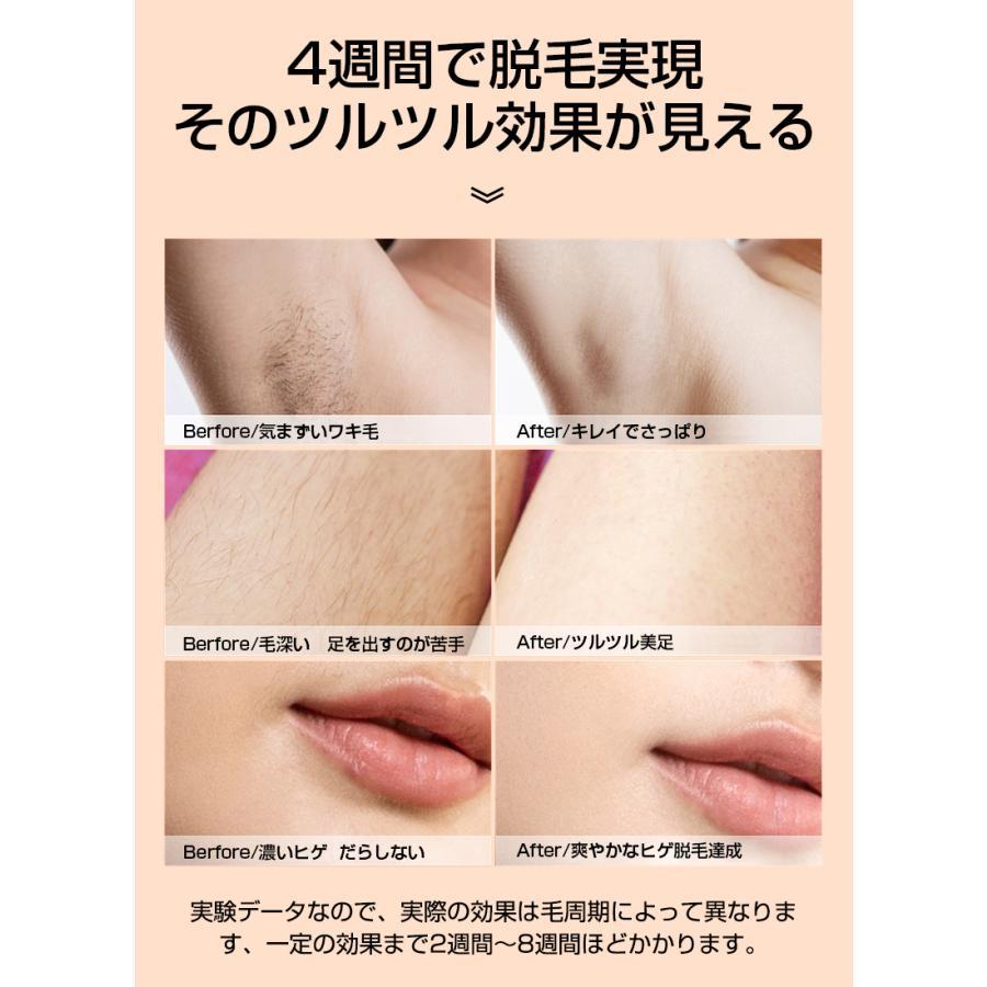 26ジュール LOMAYA IPL光脱毛器 ハイパワー VIO 冷却 無限 シミ