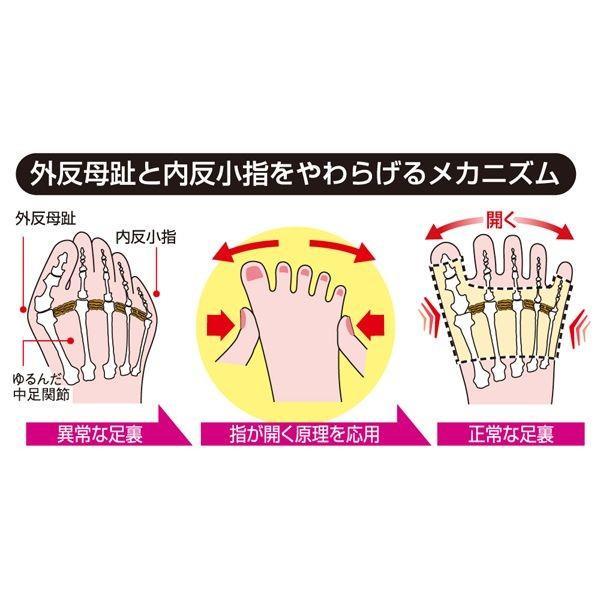 アルファックス 203926 外反母趾・内反小指サポーター Mサイズ・右足用 |  | 04