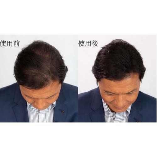 スーパーミリオンヘアー 2個セット No.1 ブラック ルアン 30g : idx