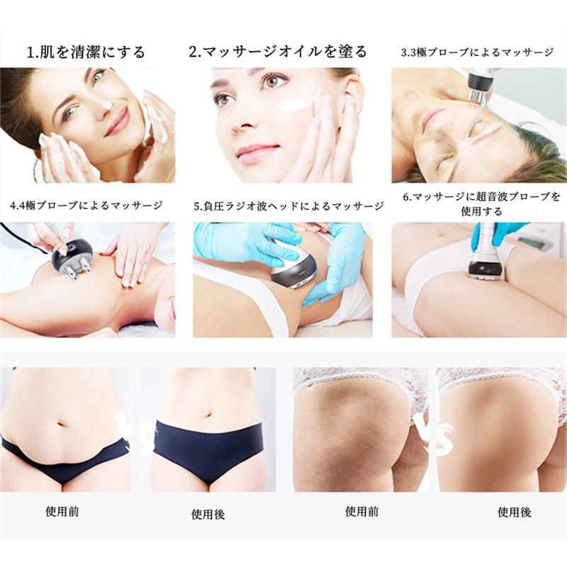 キャビテーション 業務用/家庭用 4in1 40khz ラジオ波 多極RF キャビテーション 業務用/家庭用 4in1 40khz ラジオ波 多極RF