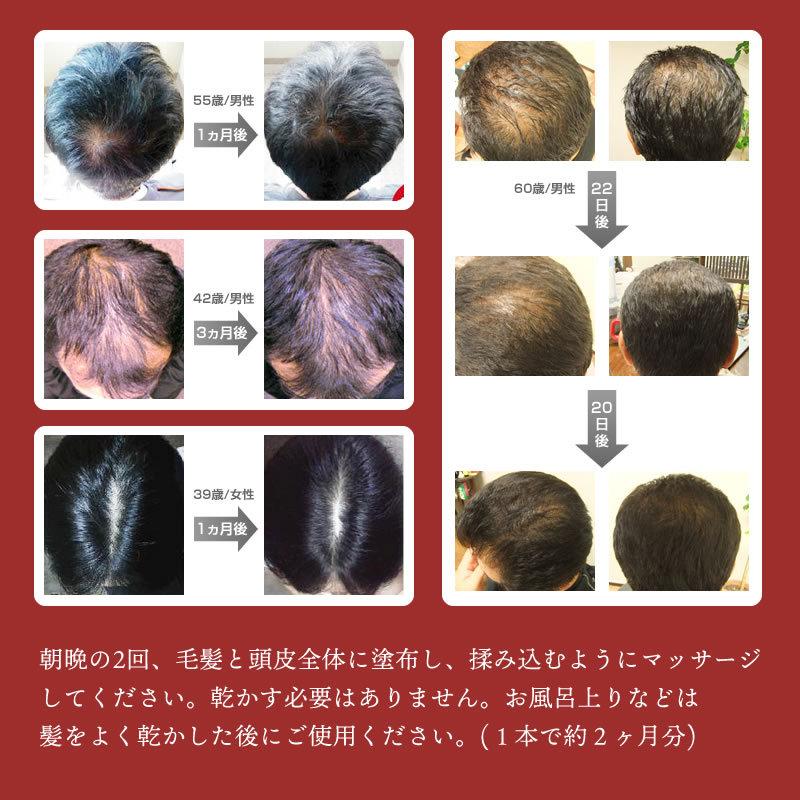 リモウケア・スカルプケアローション(6本セット)|ミドリムシ育毛 