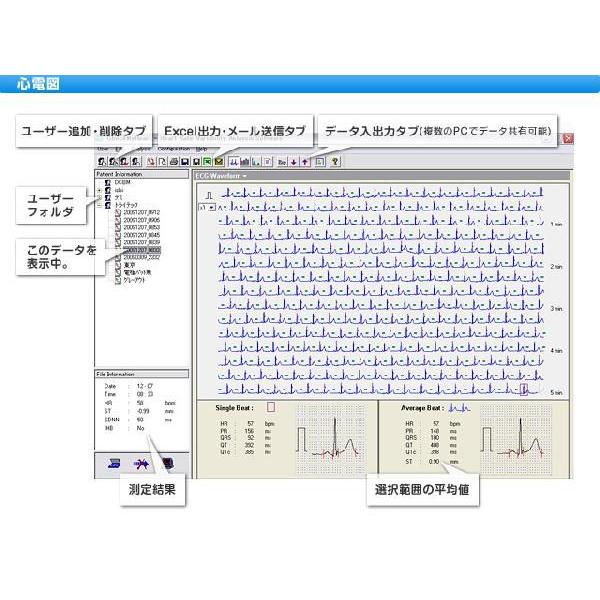 携帯型心拍変動測定器「チェックマイハート」CMH〜お取り寄せ：送料無料 | ブランド登録なし | 01