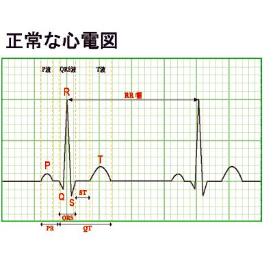 心電計 リードマイハート 携帯型 RMH 親指 日本語 送料無料 | ブランド登録なし | 01