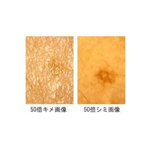 肌の状態を拡大画像表示するビデオルーペ スキンチェックセット Vl 5 お取り寄せ 送料無料 Vl 5 いま何度 通販 Yahoo ショッピング