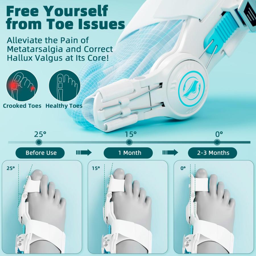 【並行輸入品】Kutain Upgraded Bunion Corrector for Women & Men， Orthopedic Bun_3