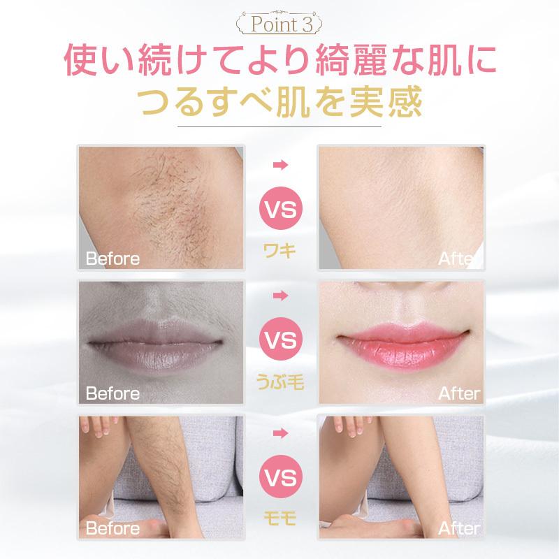 2000円OFF実施中】 脱毛器 IPL光脱毛 VIO対応 メンズ レディース 99万