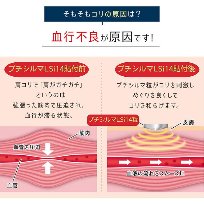 2個セット レダ Dr.プチシルマ LSi14DX 5.5mm 6粒入×2個セット 12粒 一般医療機器 鍼灸式 貼付型 新素材 硬質シリコンの画像