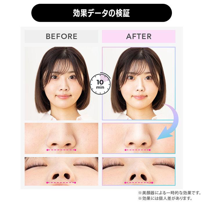 Dr.ibis EMS 美顔器 痩身機器 ジェル4本付 動作確認済 即使用OK LUXCEAR（ルクセア） フォーネスPRO 鼻専用EMS美顔器 音波EMS 小鼻ケア