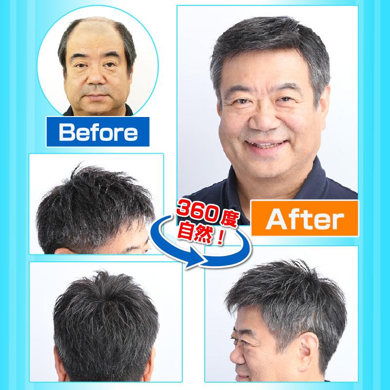 極薄オーダーかつら　オーダーメイドかつら　カツラ　男性用　メンズ　ウィッグ 送料無料の画像