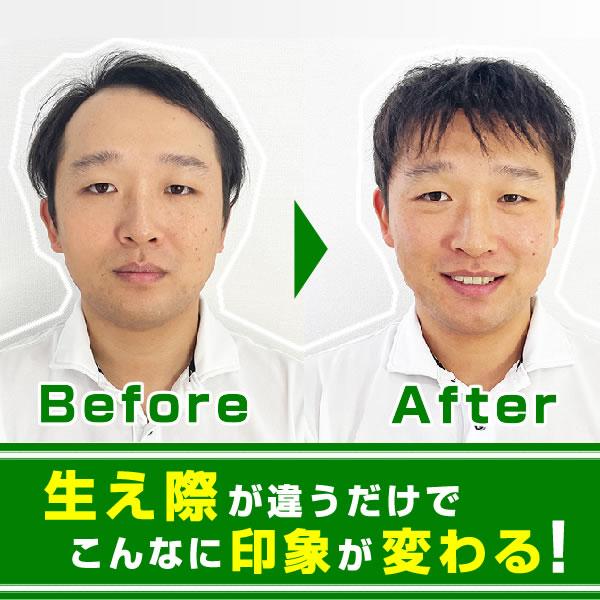 【ポイント10％中6/7まで】頭皮一体増毛 ヘアーインプラントEX フロント用　※装着にはテープかシリコンが必要ですの画像