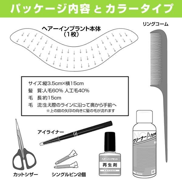 【ポイント10％中6/7まで】頭皮一体増毛 ヘアーインプラントEX フロント用　※装着にはテープかシリコンが必要ですの画像