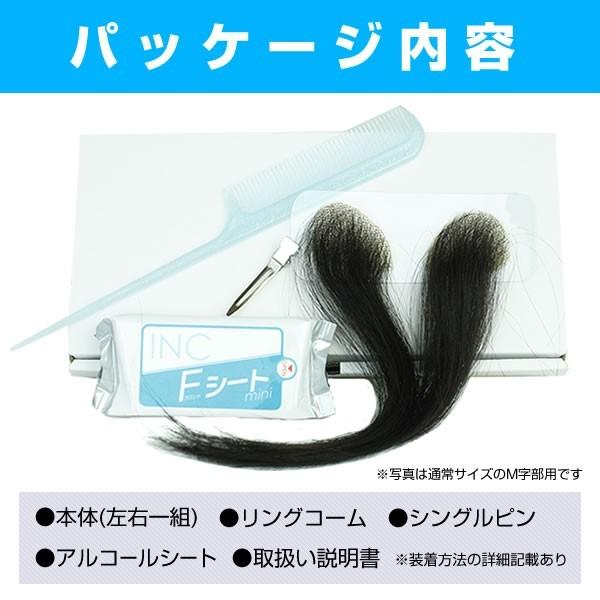 頭皮一体増毛 ヘアーインプラントEX Ｍ字部用ＢＩＧ｜increasehair｜05