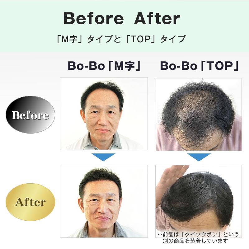 Bo-Bo (TOPタイプ) 部分かつら　増毛　BoBo　ボーボ　頭頂部　天頂部　メンズウィッグ　薄毛隠し　インクリーズヘアーの画像