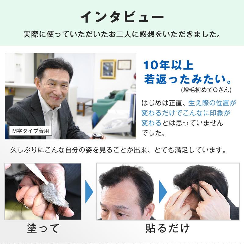 Bo-Bo (TOPタイプ) 部分かつら　増毛　BoBo　ボーボ　頭頂部　天頂部　メンズウィッグ　薄毛隠し　インクリーズヘアーの画像