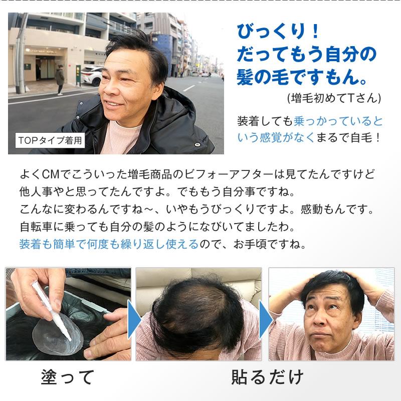 Bo-Bo (TOPタイプ) 部分かつら　増毛　BoBo　ボーボ　頭頂部　天頂部　メンズウィッグ　薄毛隠し　インクリーズヘアーの画像