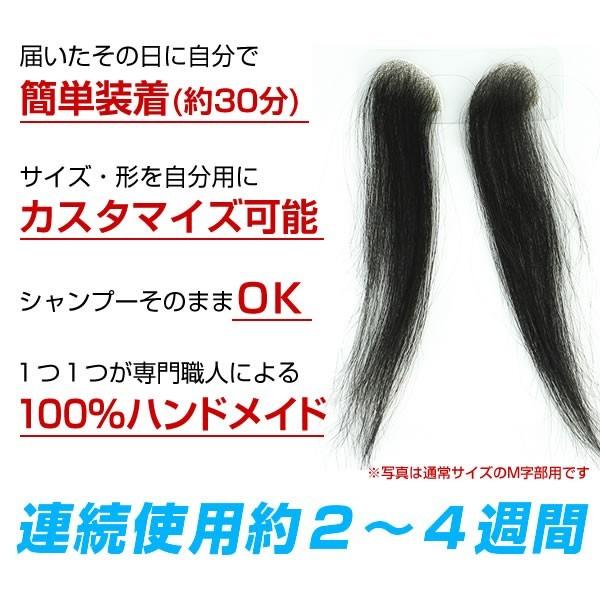 【ポイント10％中6/7まで】【リピーターパック】ヘアーインプラントEX Ｍ字部用ＢＩＧの画像