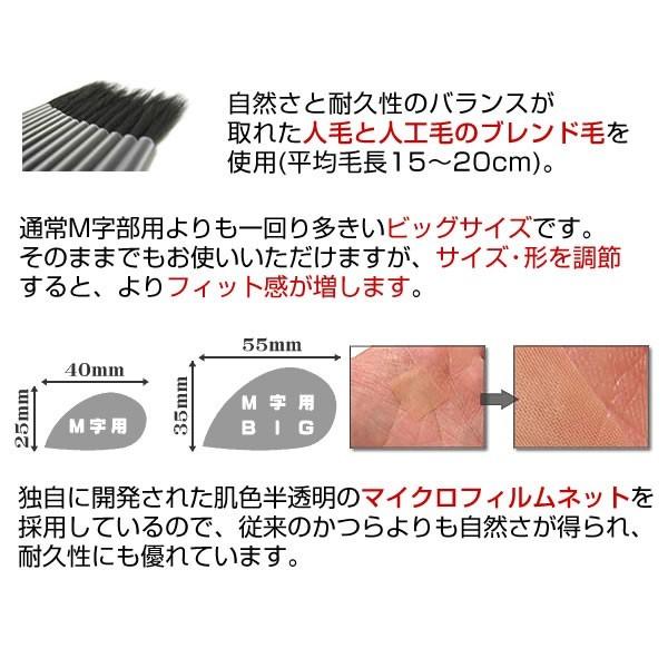 【ポイント10％中6/7まで】【リピーターパック】ヘアーインプラントEX Ｍ字部用ＢＩＧの画像