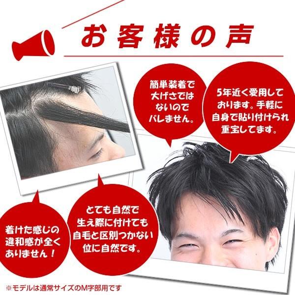 【ポイント10％中6/7まで】【リピーターパック】ヘアーインプラントEX Ｍ字部用ＢＩＧの画像