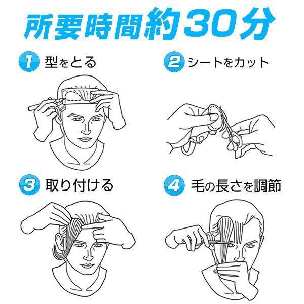 【ポイント10％中6/7まで】【リピーターパック】ヘアーインプラントEX Ｍ字部用ＢＩＧの画像