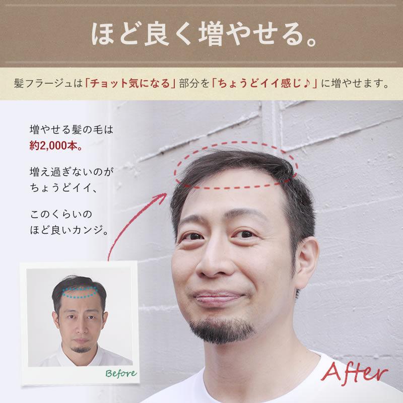 髪フラージュ カミフラージュ KAMIFLAGE セルフ増毛 貼る増毛 生え際 
