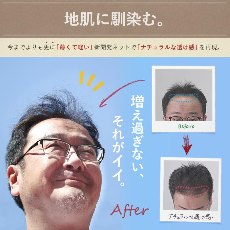 【ポイント10％中6/7まで】【リピーターパック】髪フラージュ　カミフラージュ　KAMIFLAGE　セルフ増毛　貼る増毛　生え際の画像