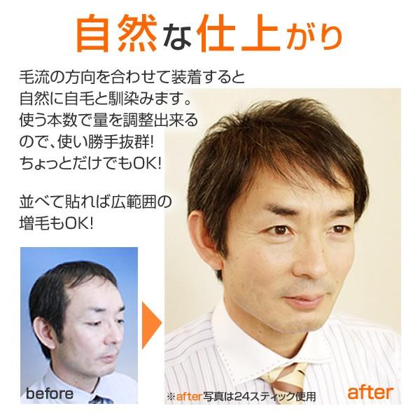 クイックPON(お試し5本入り) かつら男性用 男女兼用 メンズ ウィッグ