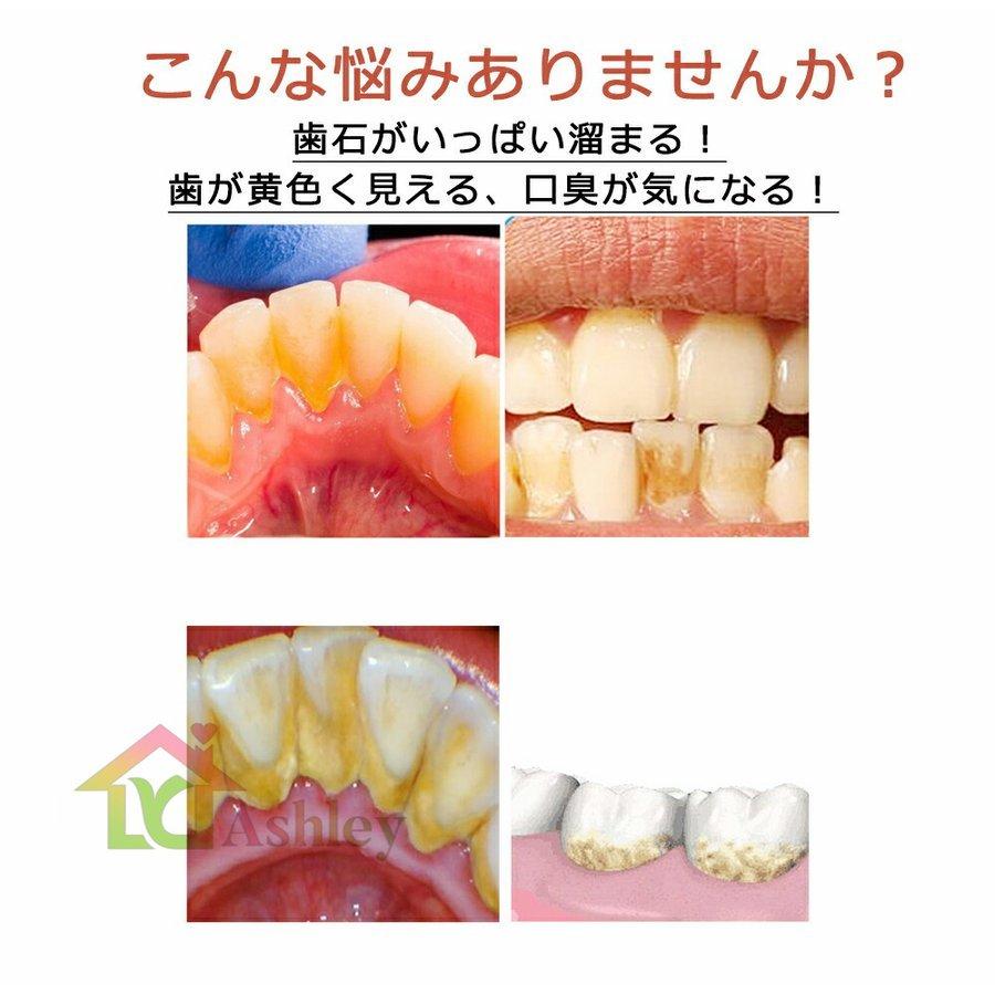 電動歯ブラシ 口腔洗浄器 歯石取り スケーラー 超目玉 超音波 電気歯クリーナー 高周波振動 電気歯洗浄機 防水 口臭防止 Led 歯周病予防 歯垢 歯茎 電動ブラシ 口腔ケア