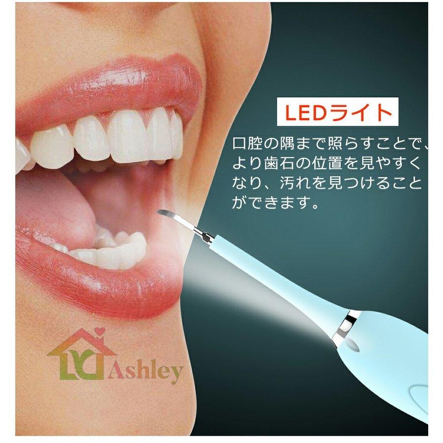 電動歯ブラシ 口腔洗浄器 歯石取り スケーラー 超目玉 超音波 電気歯クリーナー 高周波振動 電気歯洗浄機 防水 口臭防止 Led 歯周病予防 歯垢 歯茎 電動ブラシ 口腔ケア