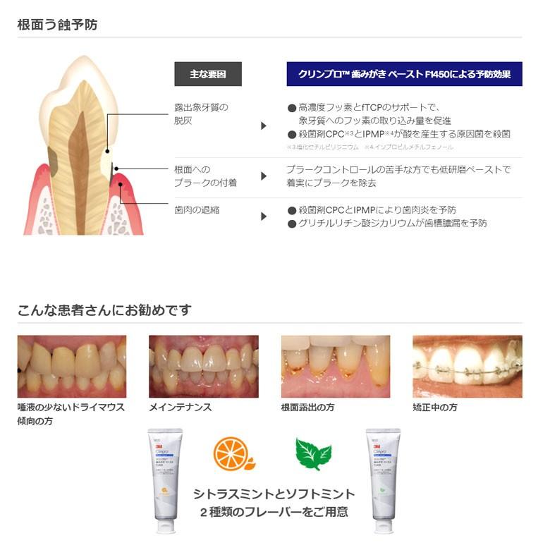 フッ素 歯磨き粉 3m クリンプロ歯みがきペーストf1450 90ｇ メール便不可 オーラルケアのdod 通販 Yahoo ショッピング