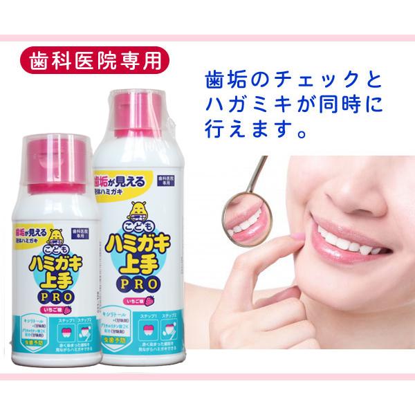 松風 11/22.23限定！5%OFFクーポン！歯科医院専用 ハミガキ上手PRO 小