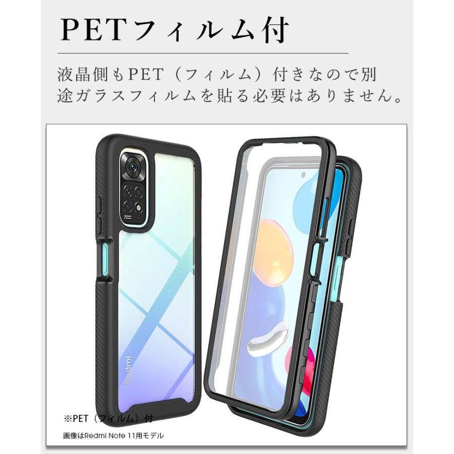 Xiaomi Redmi Note 11 本体 SIMフリー ケース付き Redmi Note 11
