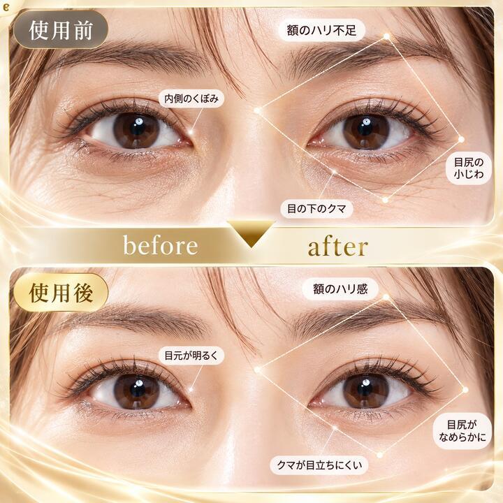 目元ケア EMS 美顔器 目元マッサージャー ems アイマッサージャー 目元
