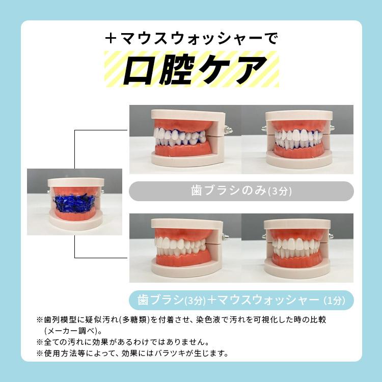 マウスウォッシャー用ノズル ノズル マウスウォッシャー ノズル単品