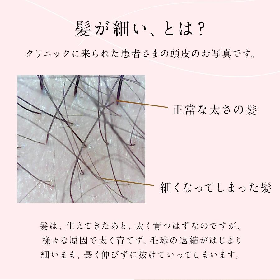 AGAスキンクリニック監修 Balumo（バルモ）Mシャンプー&トリートメント ノンシリコン アミノ酸 美髪 ハリコシ  頭皮ケア フケ かゆみ  抜け毛 美髪 AGA |  | 02