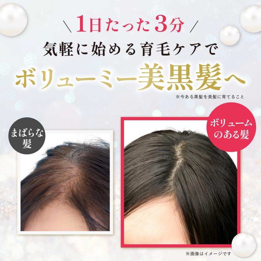 イクモア ナノグロウリッチ 女性用育毛剤(医薬部外品)130mL 約 イクモア ナノグロウリッチ 女性用育毛剤(医薬部外品)130mL 約
