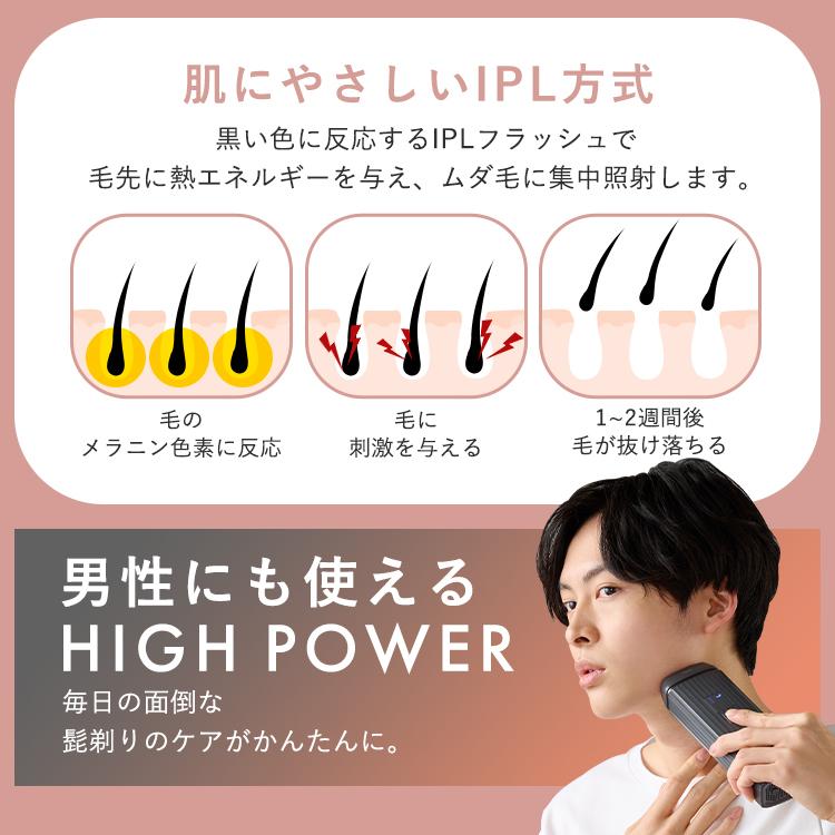 IRIS OHYAMA 光美容器 ミコラ セルフケア 全身ケア ムダ毛ケア IRIS OHYAMA 光美容器 ミコラ セルフケア 全身ケア ムダ毛ケア