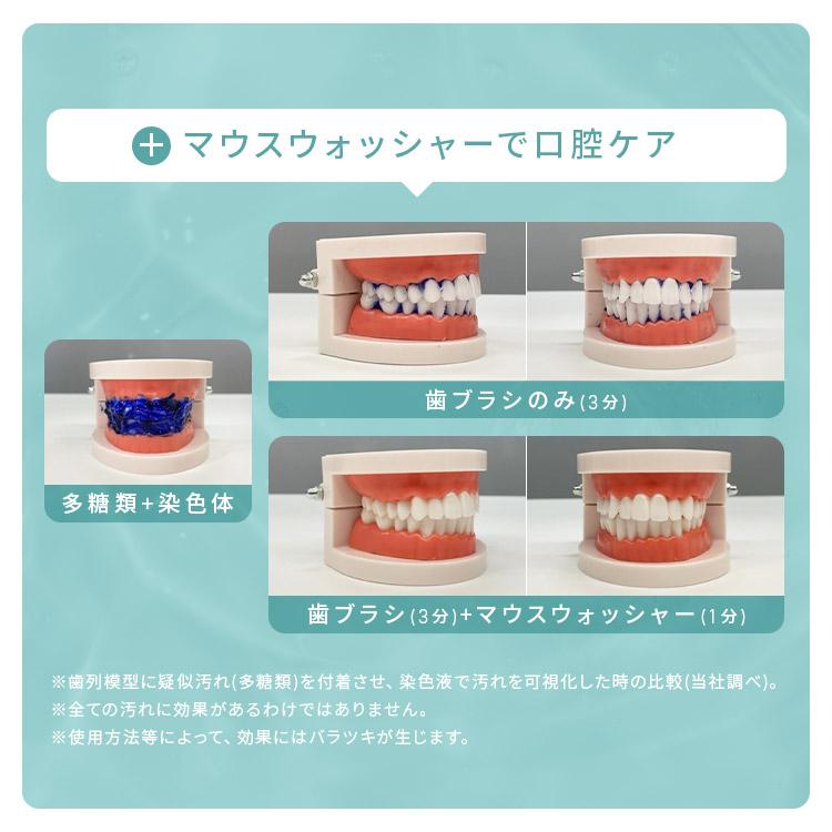 IRIS OHYAMA（アイリスオーヤマ） マウスウォッシャー 口内洗浄器