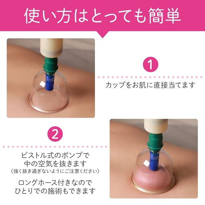 バンキー カッピング 吸い玉 カップのみ 【公式通販】