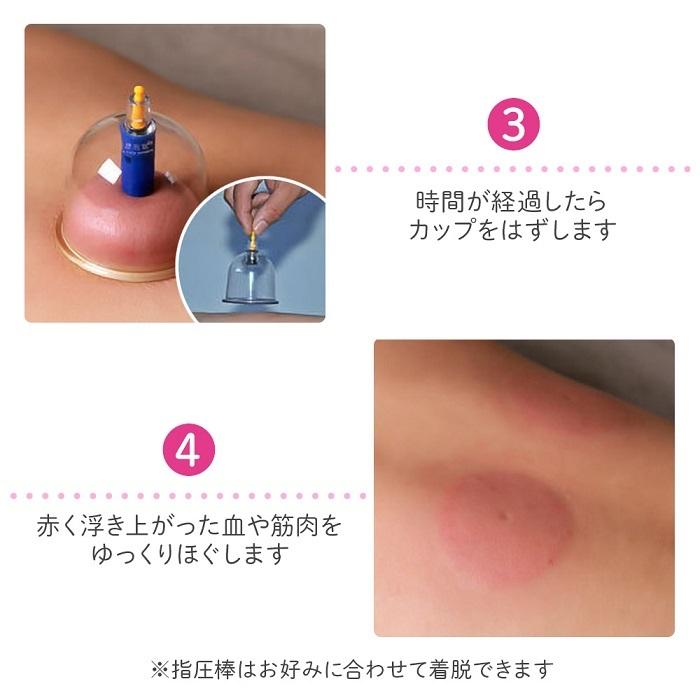カッピング 吸い玉 吸玉 カップ 6種類 24個セット ポンプ 指圧棒 延長 