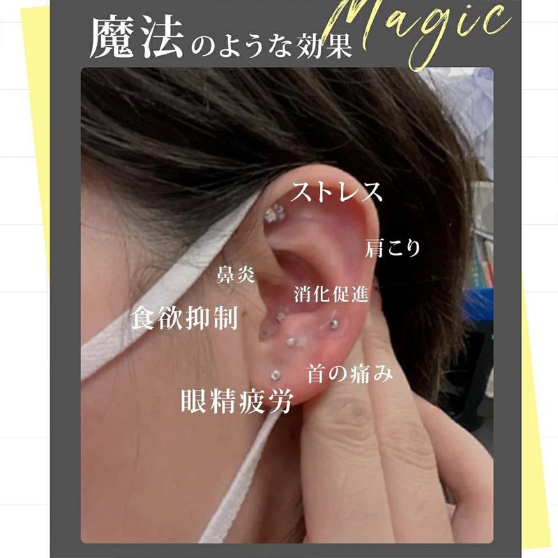 耳つぼシール 粒タイプ 100粒 金属アレルギー対応 ステンレス製 耳つぼ