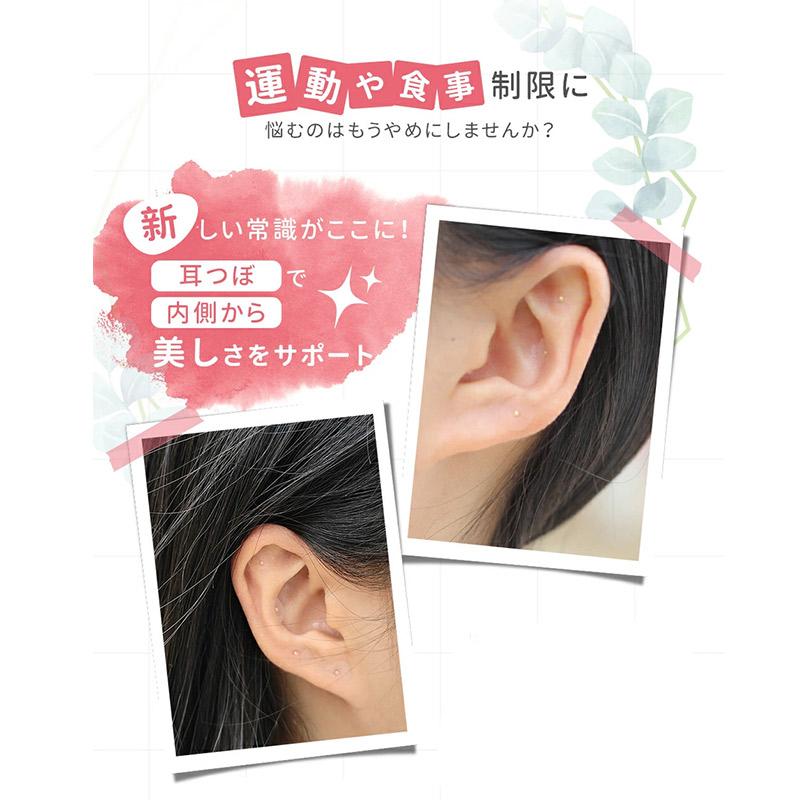 耳つぼシール 粒タイプ 100粒 金属アレルギー対応 ステンレス製 耳つぼ
