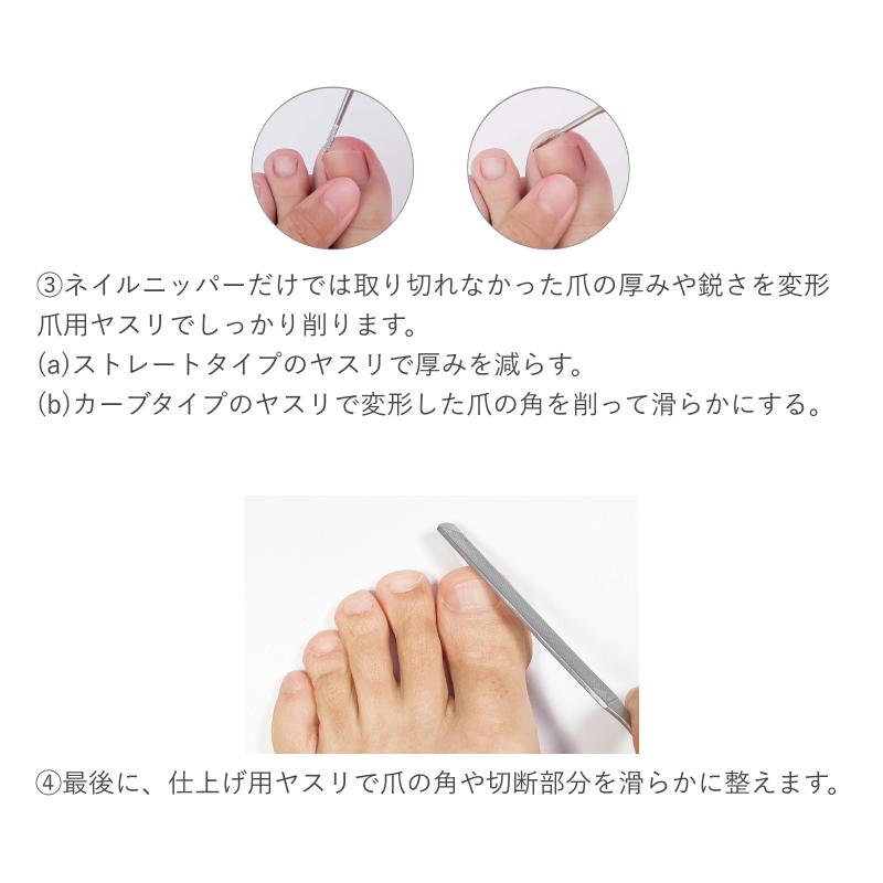 ネイルケア4点セット／ニッパー爪切り 足用 ゾンデ 巻き爪用 変形爪用