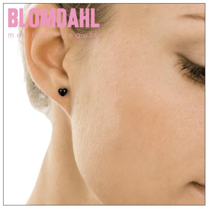 ピアス アレルギーフリー ピアス 純チタン ブラック ハート 5mm ブロムダール ハート かわいい 両耳 2個 セット 15 1521 00 15 1521 00 スマホケース ウォッチベルトのcase Camp 通販 Yahoo ショッピング