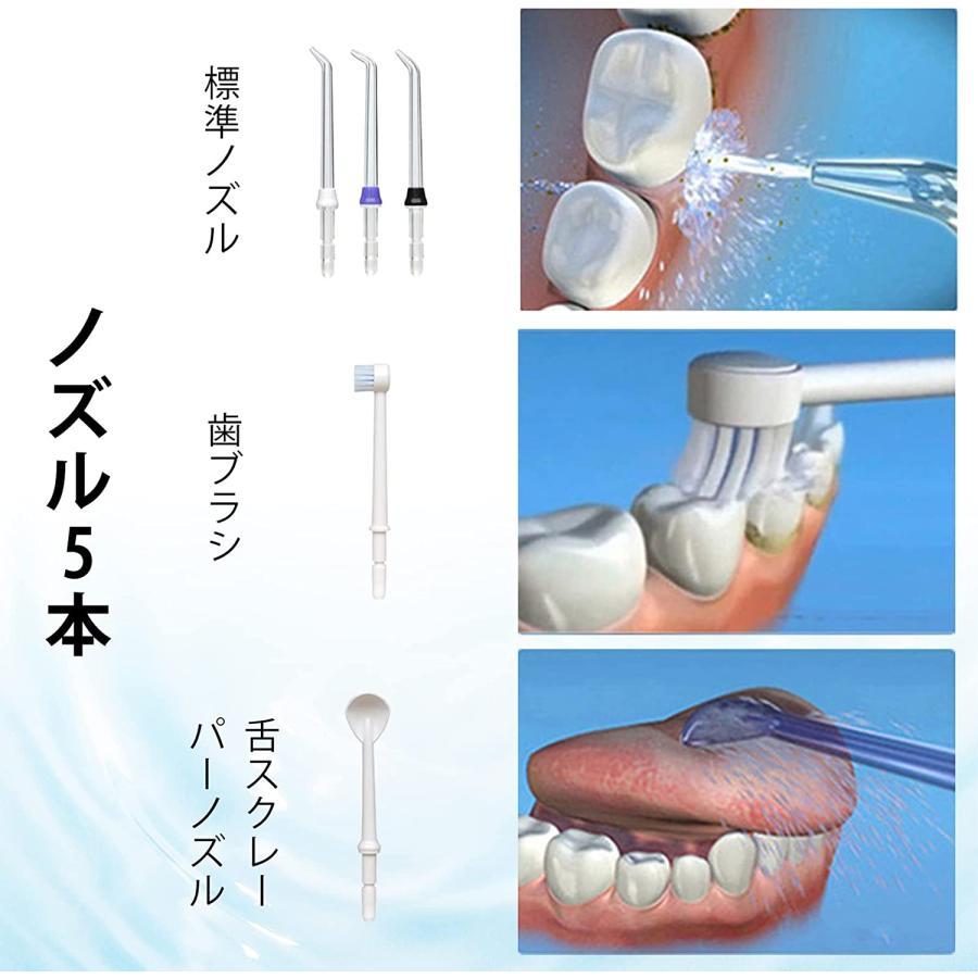 ジェットウォッシャー 口腔洗浄器 口内洗浄機 ウォーターピック 歯周