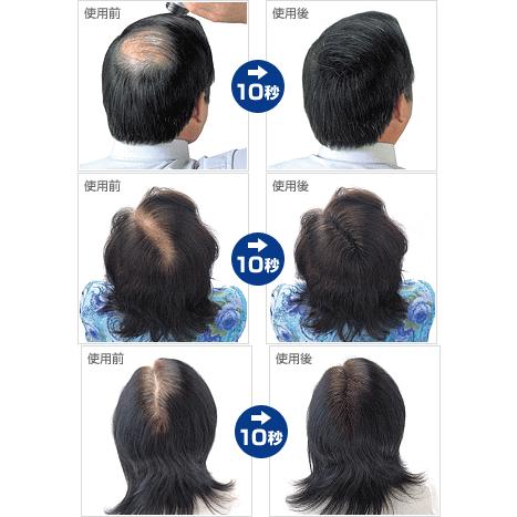 スーパーミリオンヘアー 25g(グレー) : 愛らんどびゅーてぃ - 通販