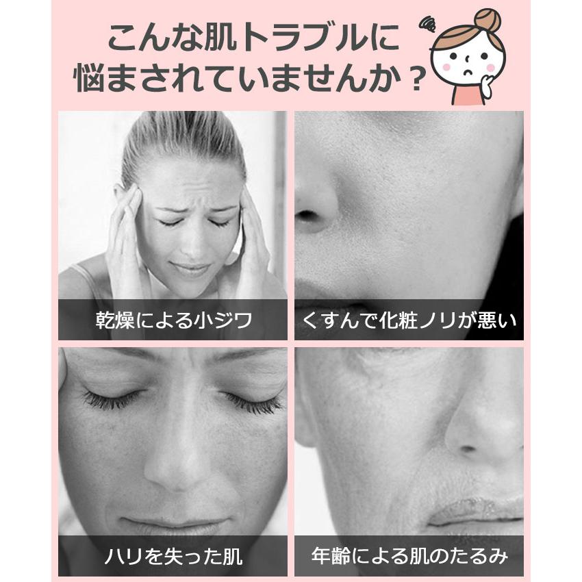 ❤エステサロンの本格肌ケアを毎日ご自宅で♪❤8in1超多機能☆美顔器 1台8役美顔器Shine シャイン 本格自宅エステ機器で美肌ケア EMS