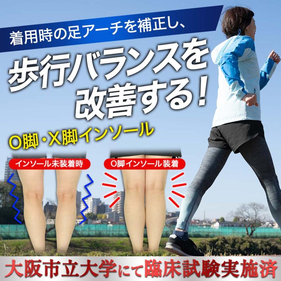 【O脚補正】 リフリーラ インソール O脚 がに股 ソール 中敷 足底板 理学療法士監修 アーチサポート |  | 01